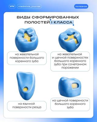 Классификация полостей: разбор на визуальных примерах.